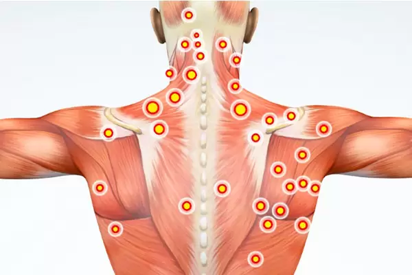 چگونگی عملکرد فاشیال درمانی